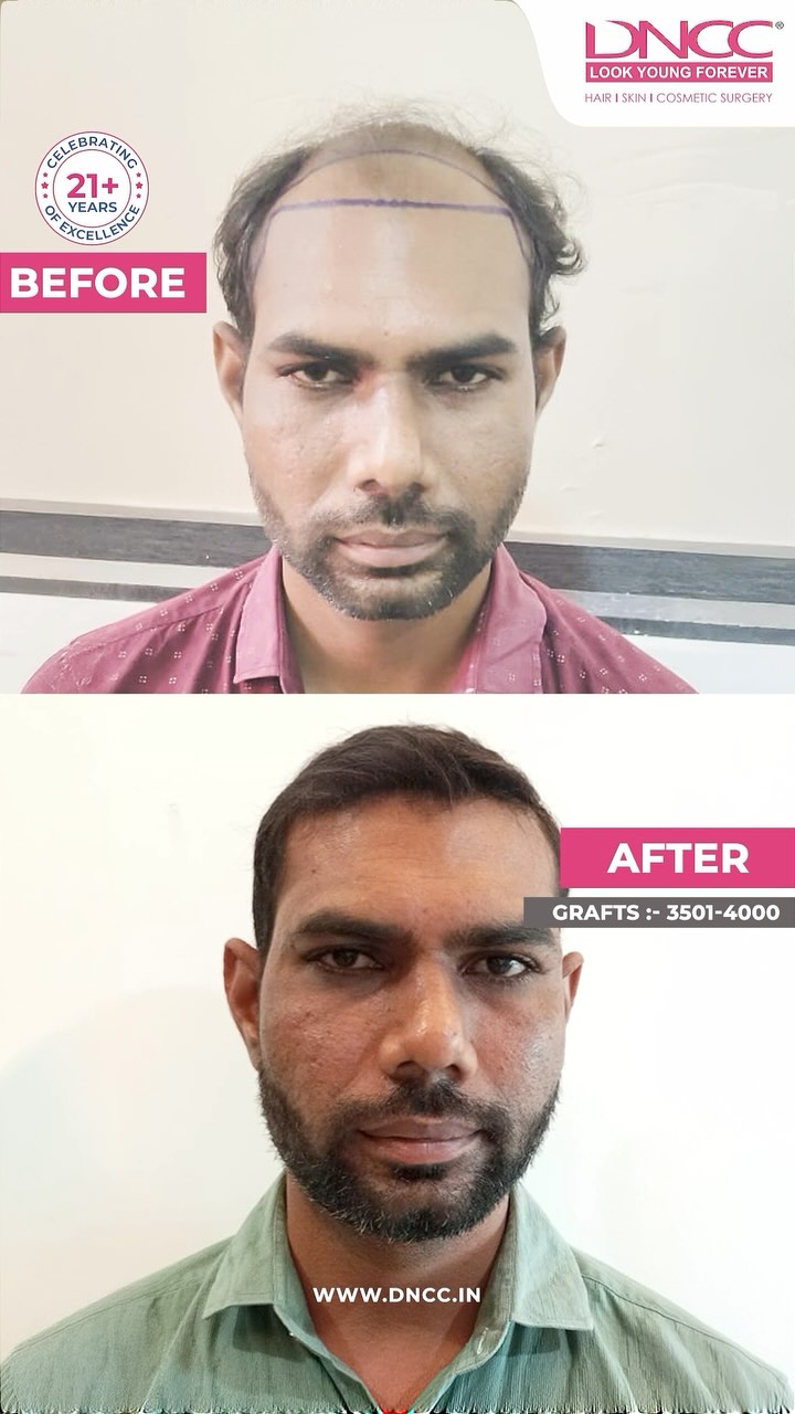 Have you tried any treatment before
