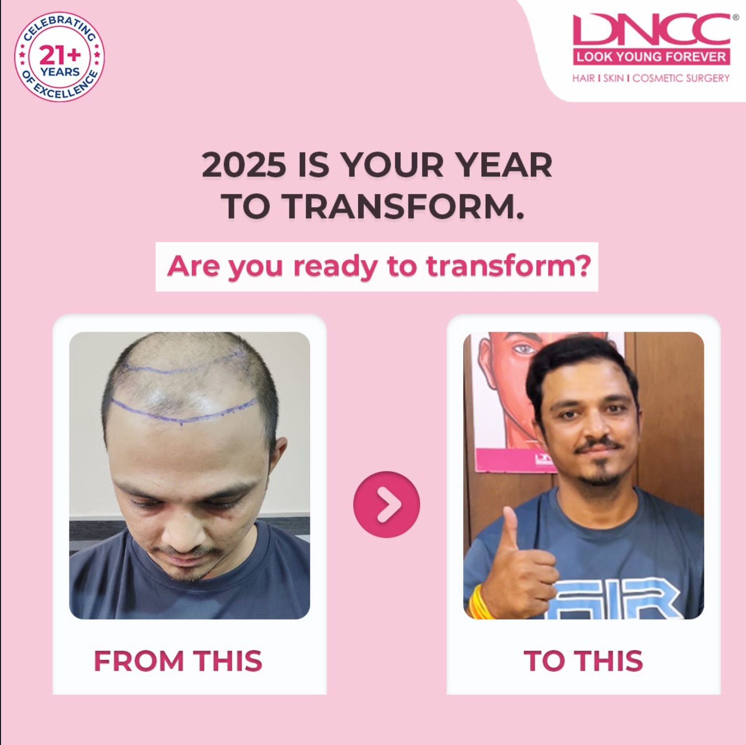 What is preventing you from booking a hair transplant today